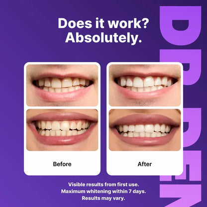 PureSmile Whitening Strips – Brighter Smile in Days